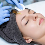 Microneedling Facials with PRP