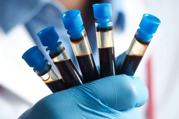 Blood Draw
